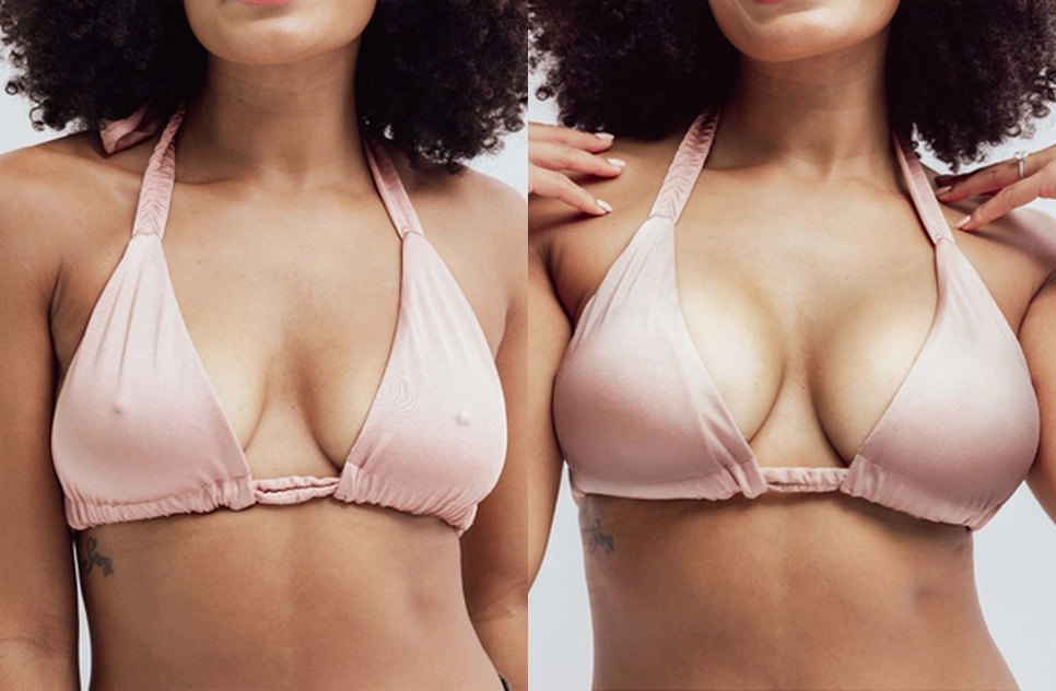 Danielle R. before and after